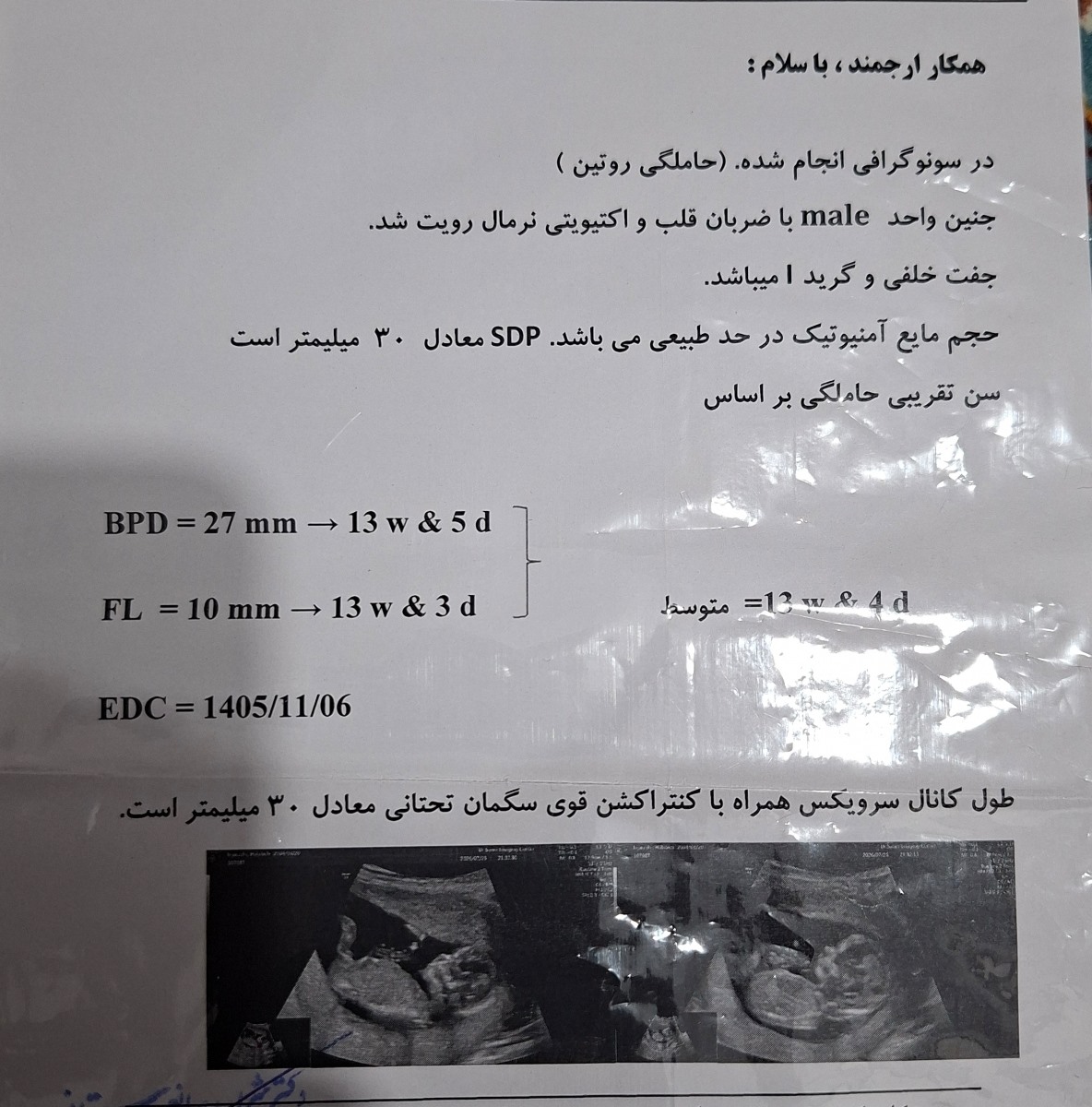 بررسی سونوی طول سرویکس بررسی سونوی طول سرویکس