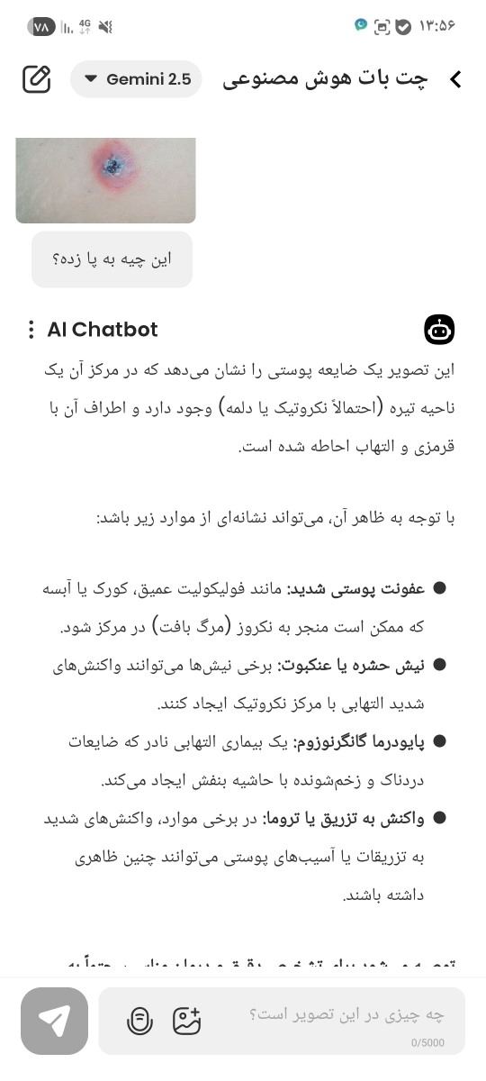 سلام این دونه رو پای دخترم دراومده چی میتونه باشه