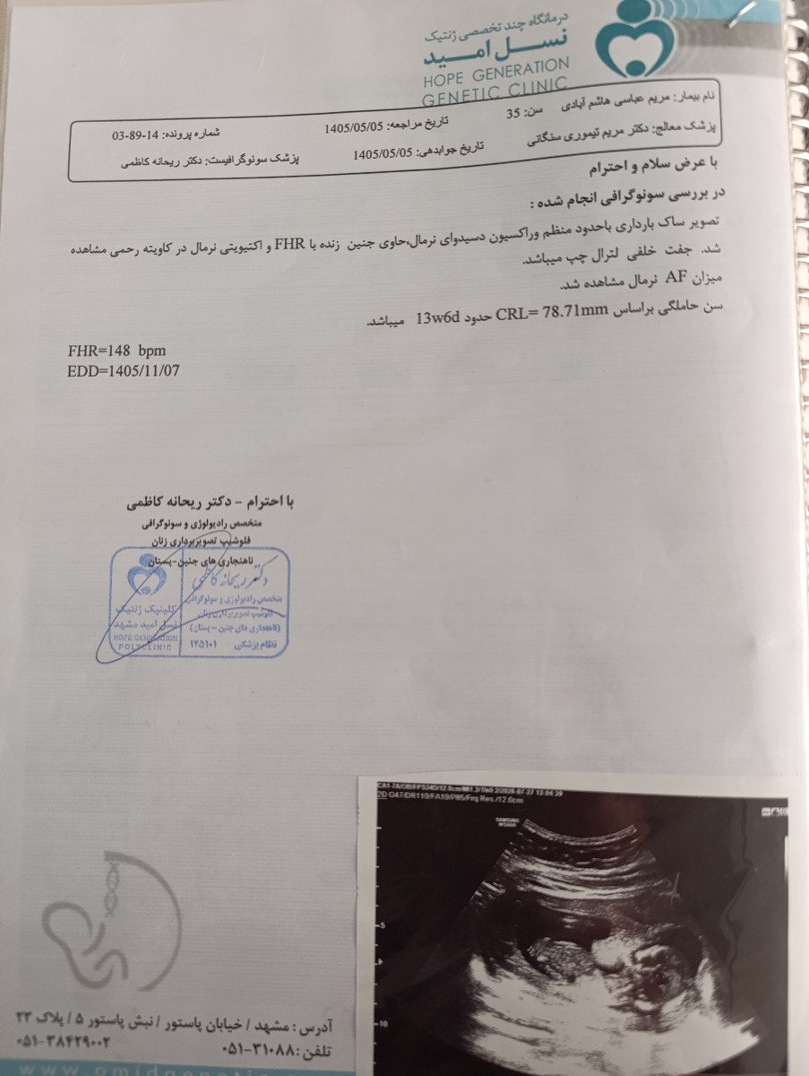 اینم سونو دیروز 