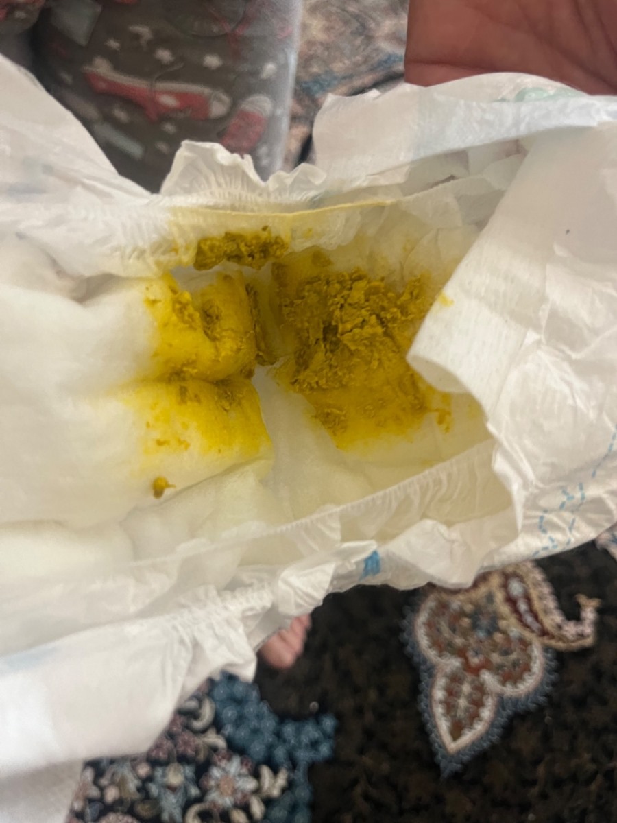 انگار سنگ ریزه است انگار سنگ ریزه است