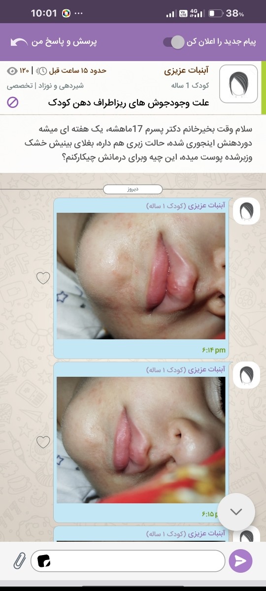 ازدیروزمنتظرم لطفاجواب بدین، پشتیبانی پیگیری کن لطفا ازدیروزمنتظرم لطفاجواب بدین، پشتیبانی پیگیری کن لطفا