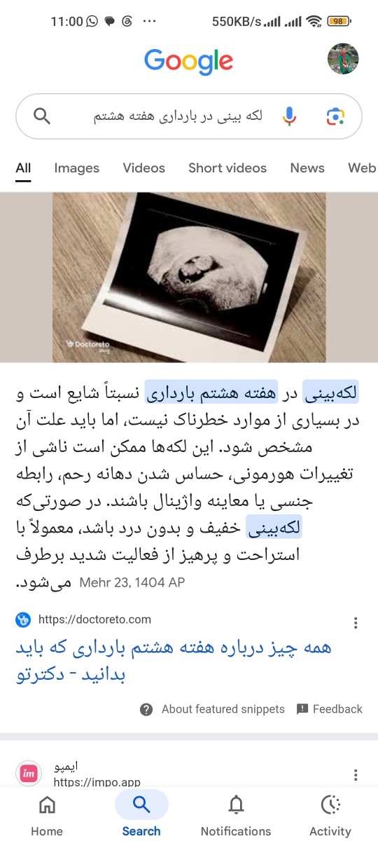 لکه بینی یا خونریزی هفته ۸ لکه بینی یا خونریزی هفته ۸