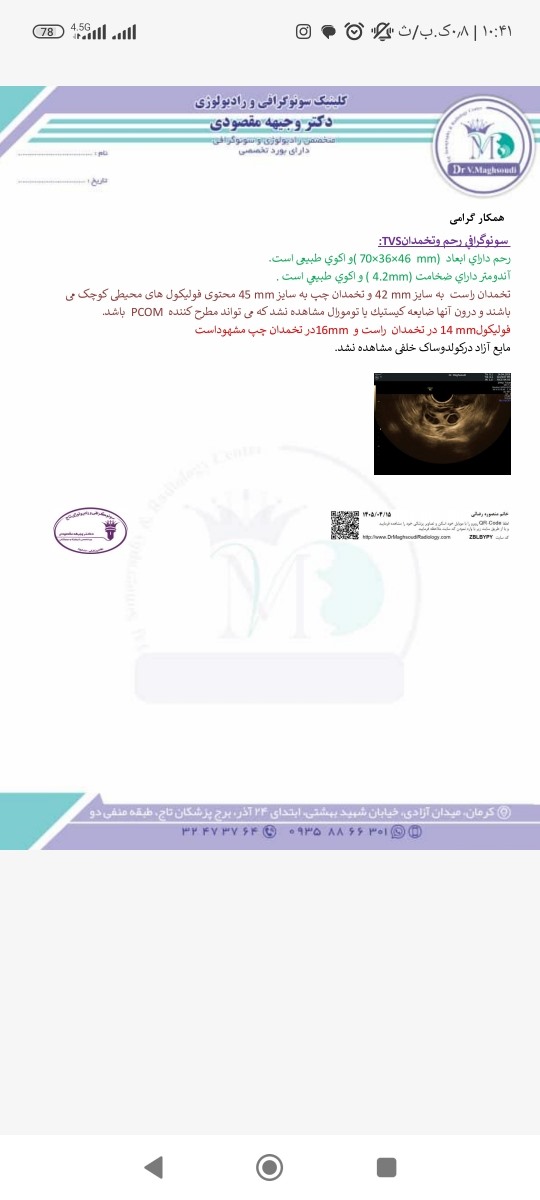 سونو ماه پیشم