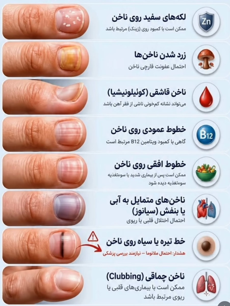 نقطه نقطه شدن روی ناخن ها