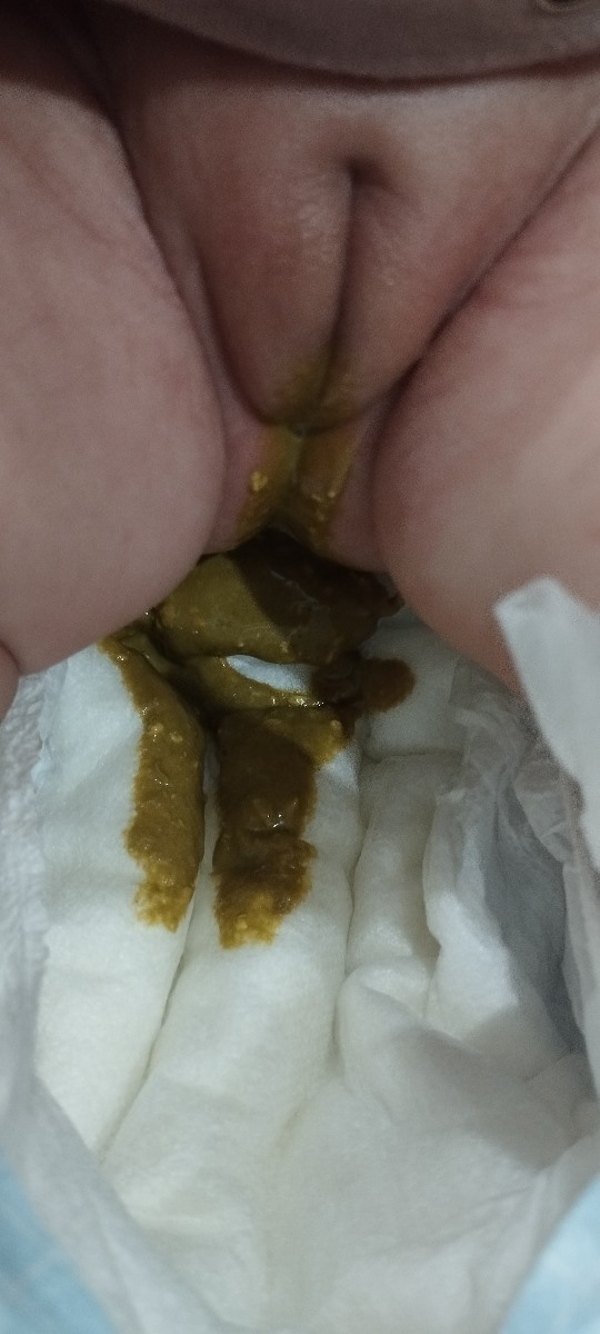 قوام مدفوع نوزاد 26روزه ❌عکس پوشک بچه داره بدت میاد نبین❌
