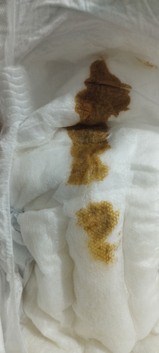 قوام مدفوع نوزاد 26روزه ❌عکس پوشک بچه داره بدت میاد نبین❌