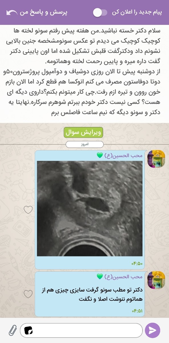 سلام دکتر هماتوم داشتم و خونریزی دارم باوجود مصرف داروها تاپیکمو چک کنید لطفا😔 سلام دکتر هماتوم داشتم و خونریزی دارم باوجود مصرف داروها تاپیکمو چک کنید لطفا😔