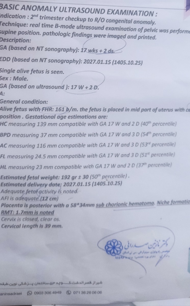 این برا دیروز