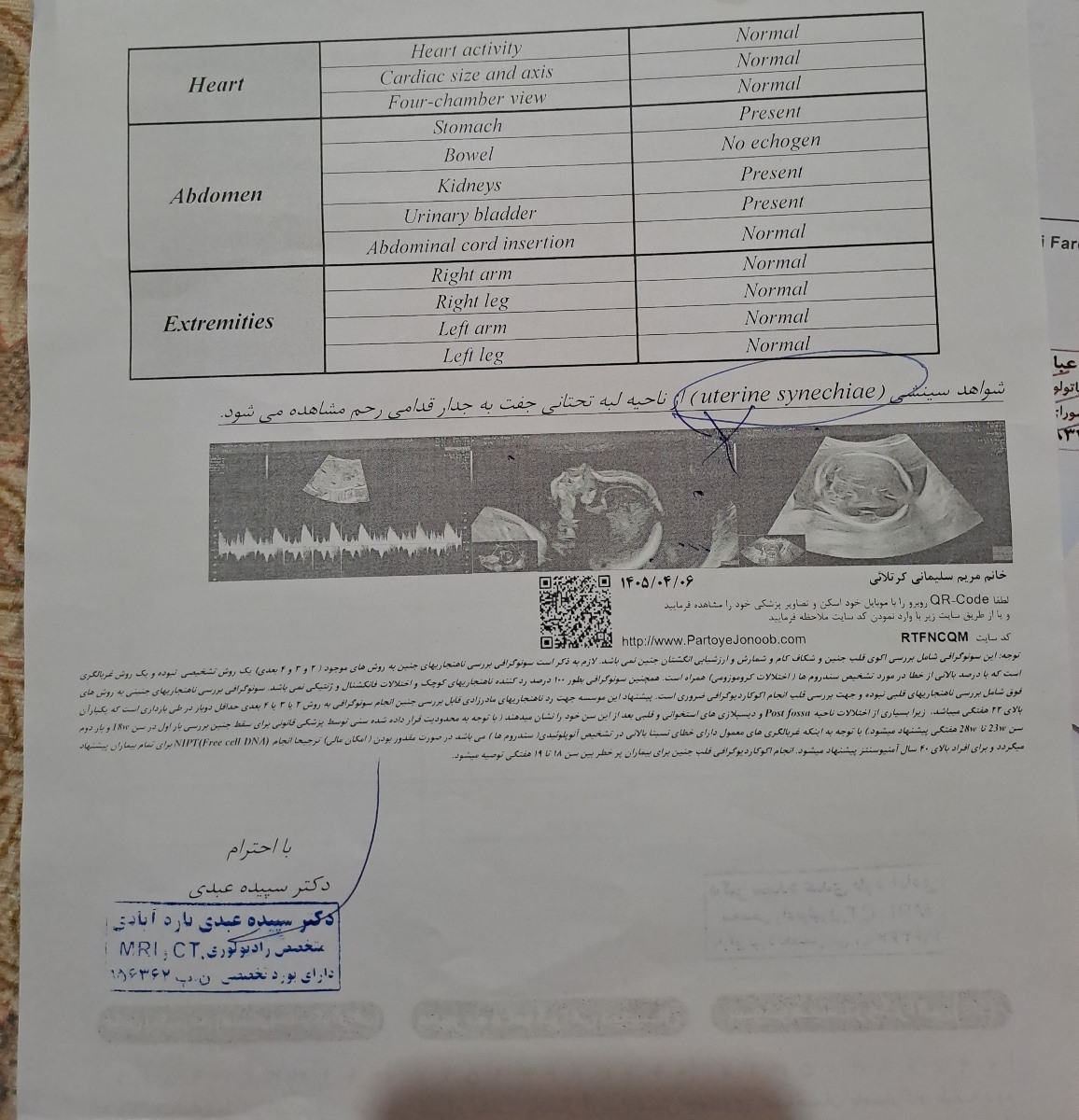 بارداری پرخطر سونو بارداری پرخطر سونو