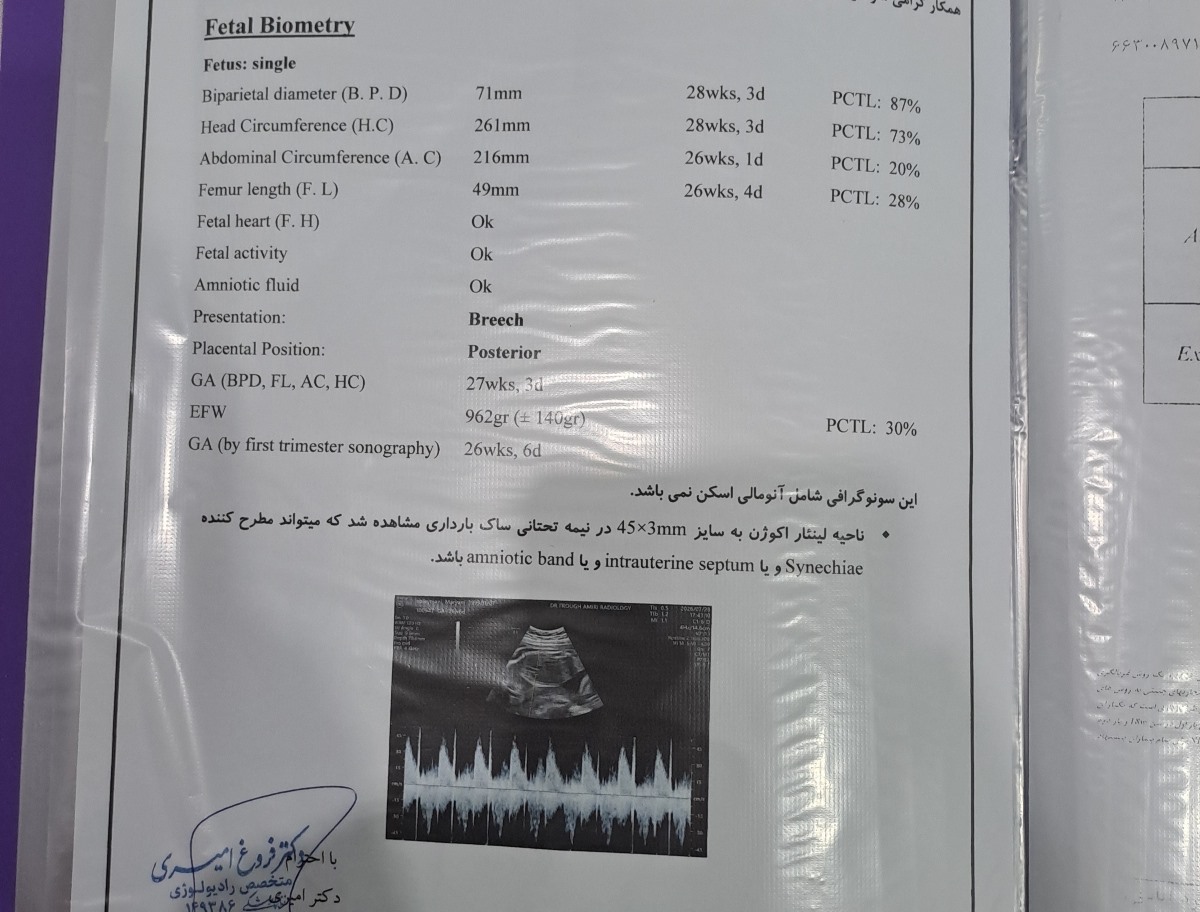 بارداری پرخطر سونو بارداری پرخطر سونو