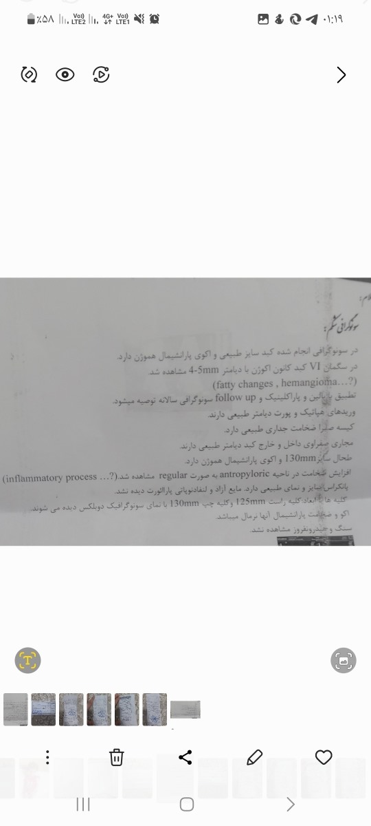 جواب سونو واندوسکوپی جواب سونو واندوسکوپی