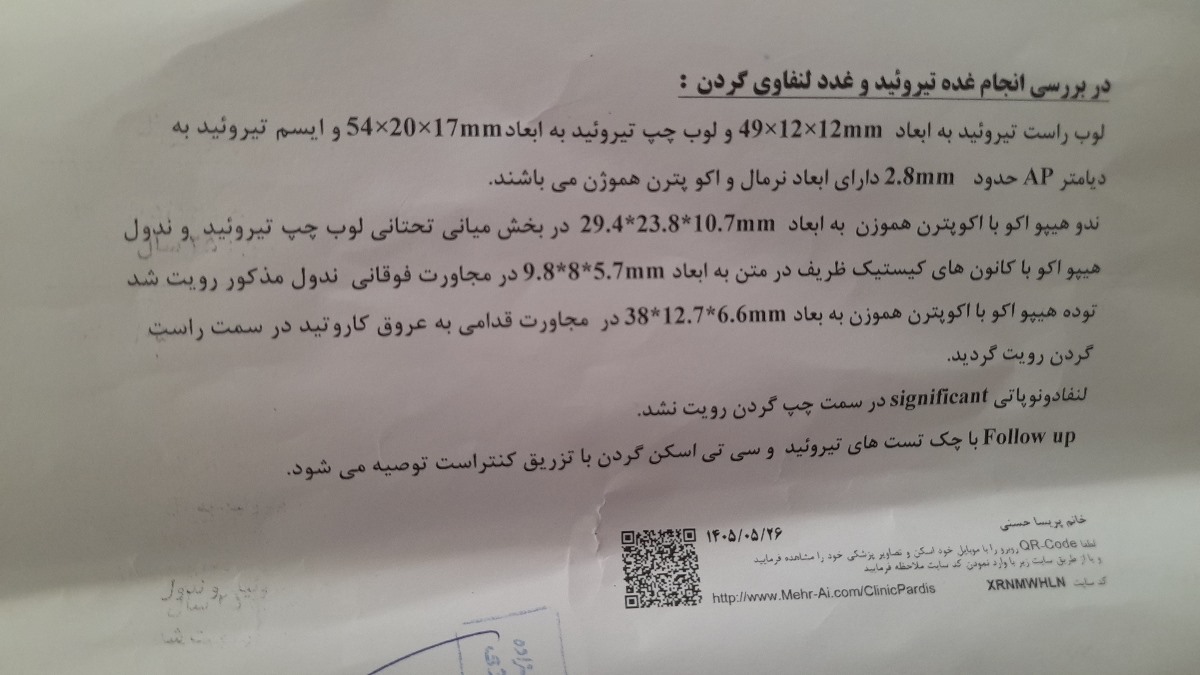 تفسیر سونو تیروئید