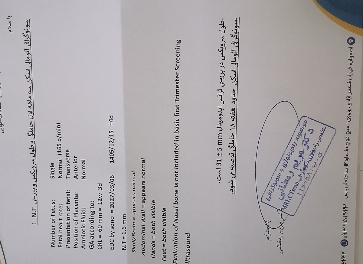 سونوی ان تی