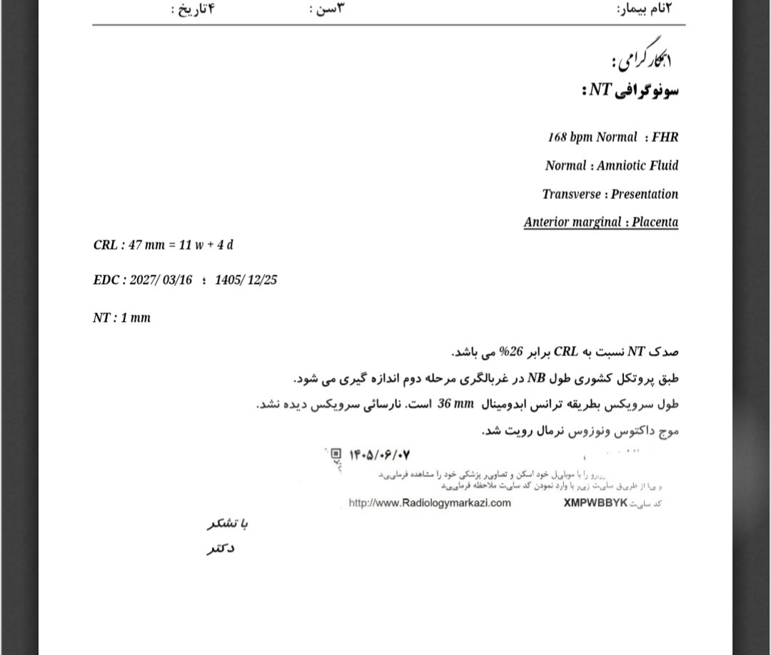 سونو ان تی خوبه