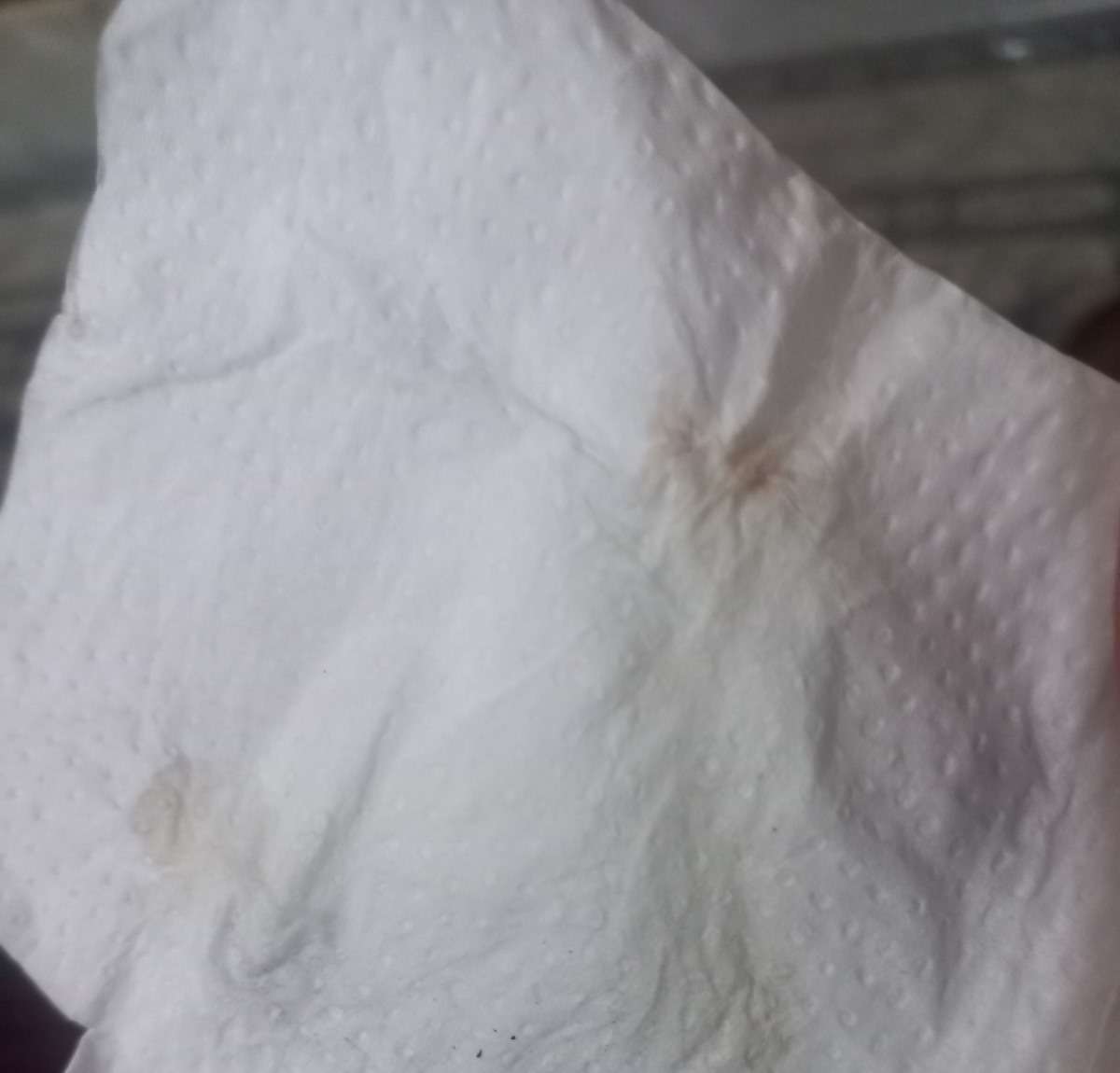 سونو ان تی خوبه