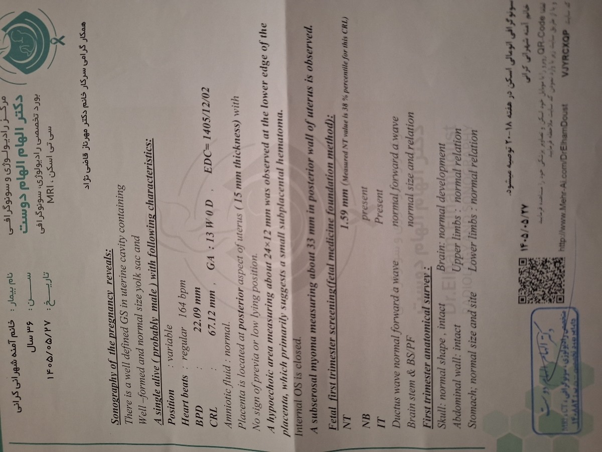 تفسیر سونو ان تی تفسیر سونو ان تی