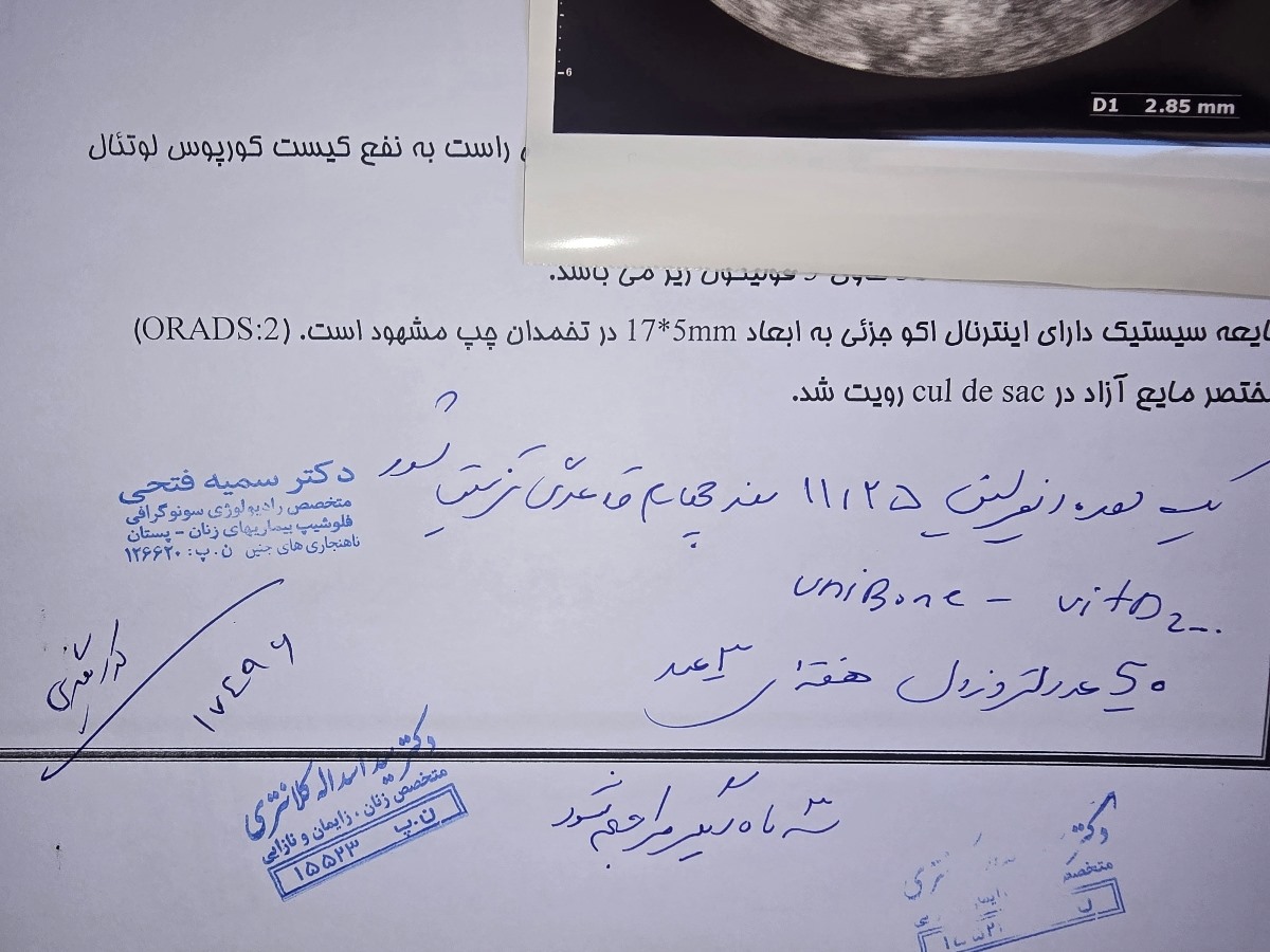 آیا این روش درمان برای رحم هتروژن مناسب است؟ آیا این روش درمان برای رحم هتروژن مناسب است؟