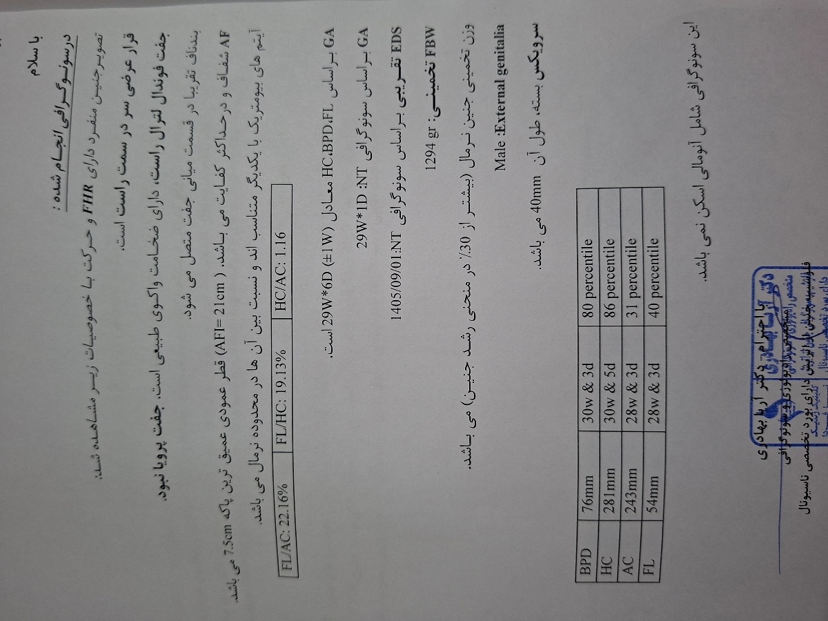 سونو وزن در ۲۹ هفته