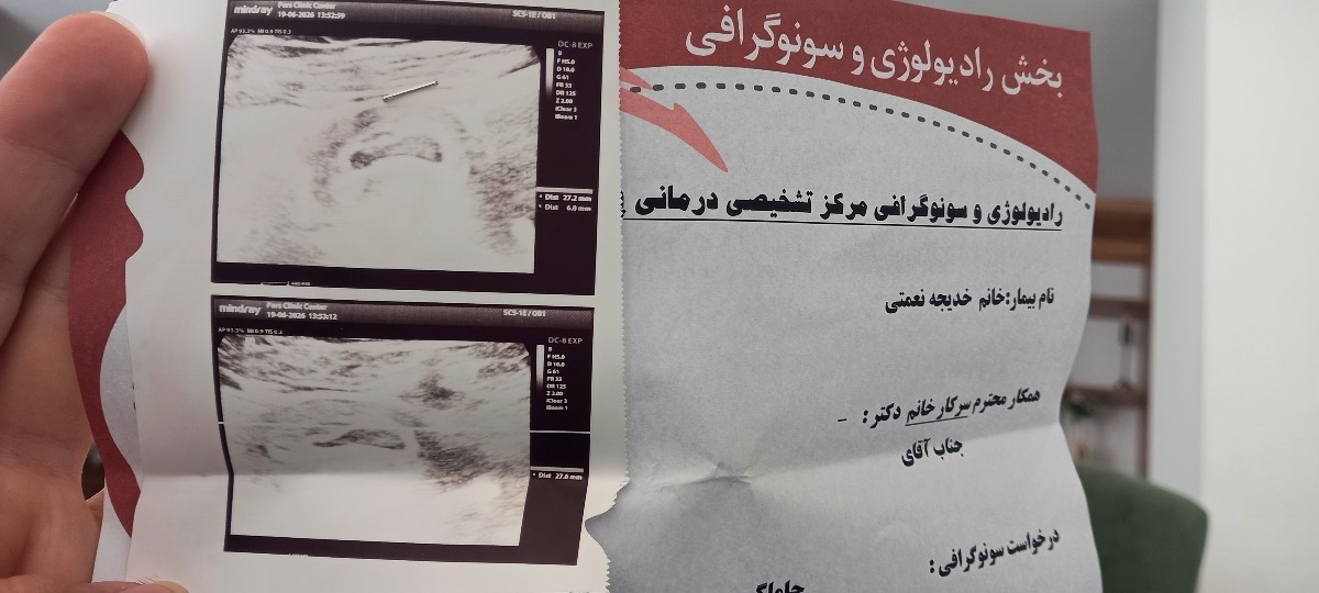 تشکیل نشدن قلب جنین تشکیل نشدن قلب جنین