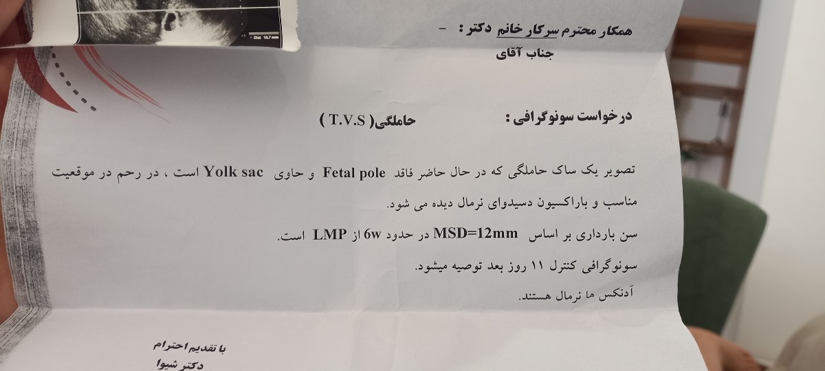 این سونو قبلی برا ۱۰ روز پیش این سونو قبلی برا ۱۰ روز پیش