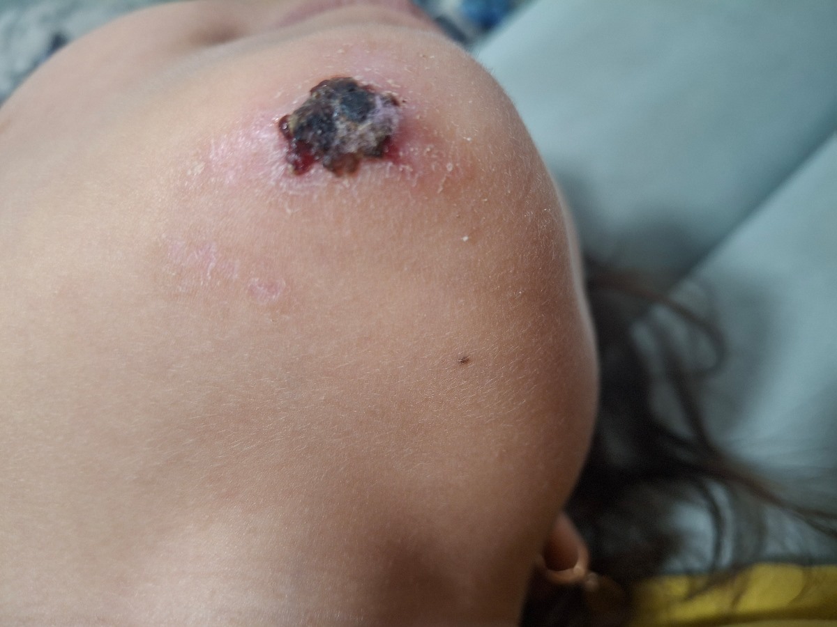 اورژانسی.. افتادن بچ روی آسفالت و زخم زیر چانه