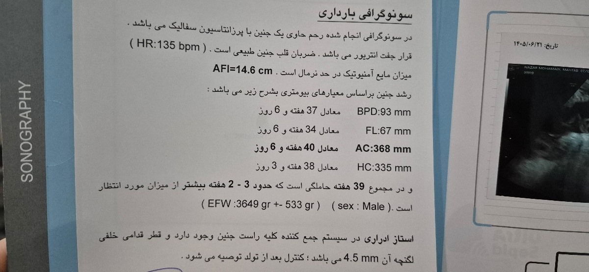 طبق سونو انتی الان ۳۶ هفته و ۵ روزم
طبق پریودی ۳۷ هفته و ۷ روز 