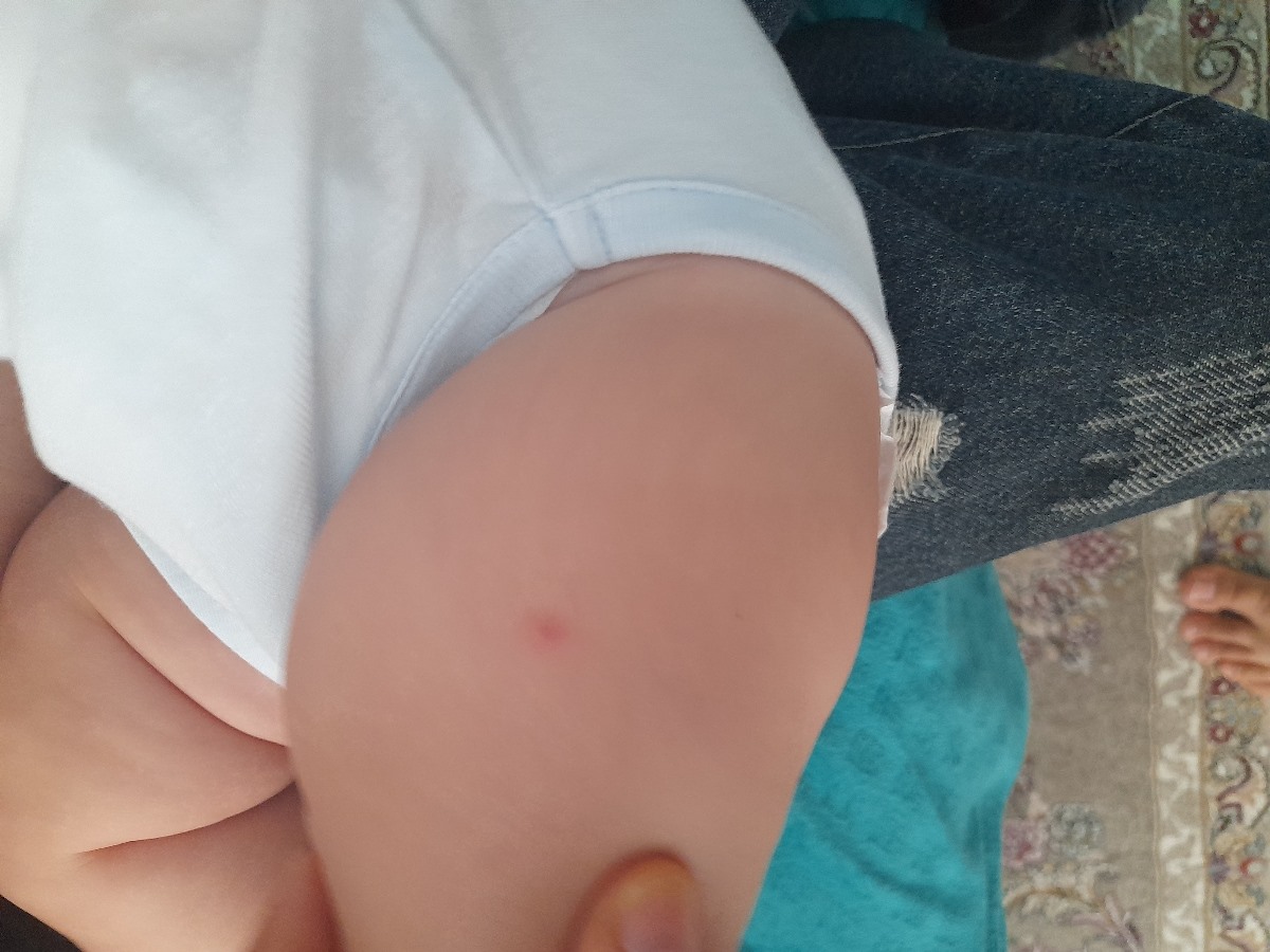 جای قرمزی