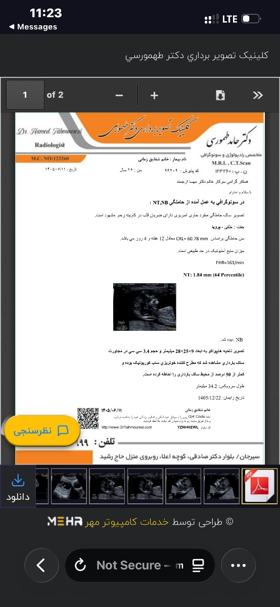 ان تی سونو ازمایش جفت