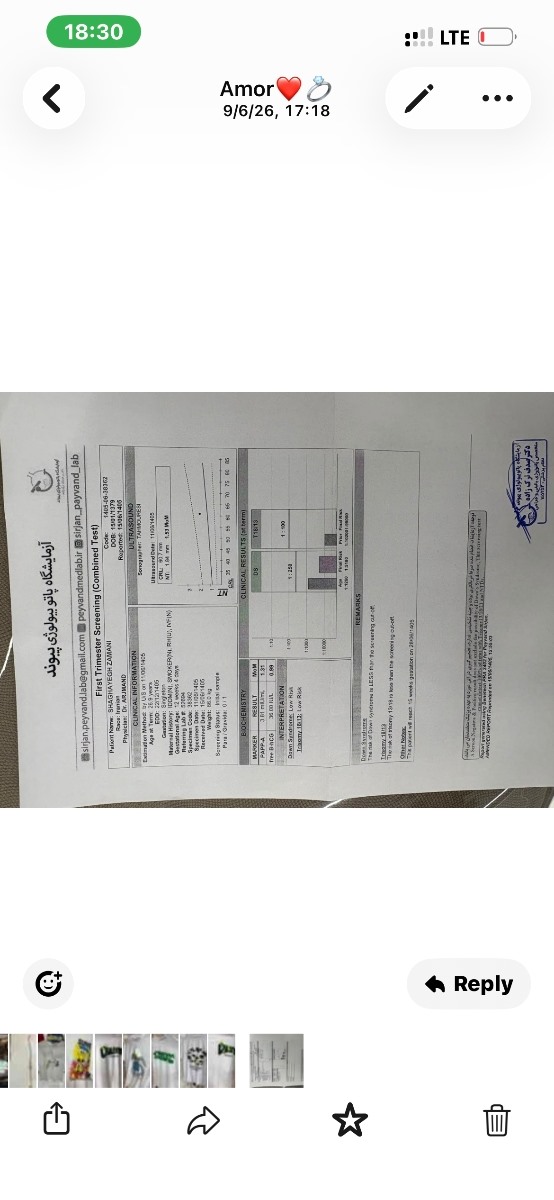 ان تی سونو ازمایش جفت
