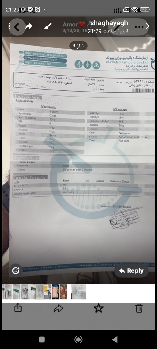 ان تی سونو ازمایش جفت