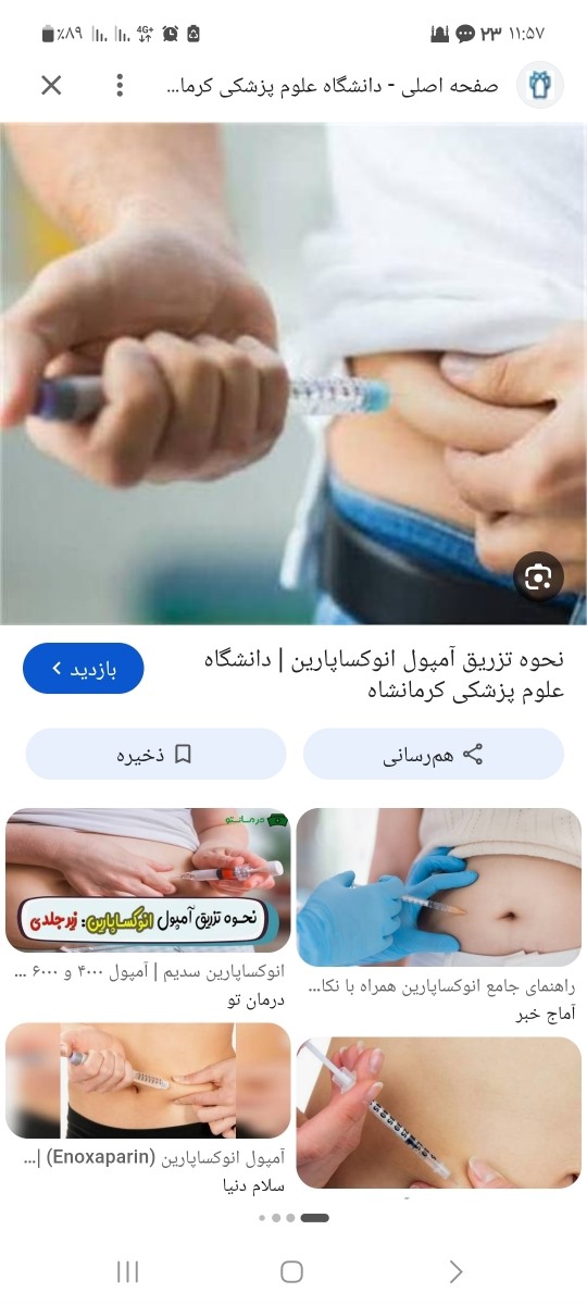 اینجوری باید بگیری محکم نگه داری تازه اینجوری دردی متوجه نمیشی
بعد از اینکه سر سوزن داخل رفت کامل این دو انگشتت رو باید برداری و آروم آروم مواد داخل سرنگ رو خالی کنی اینجوری باید بگیری محکم نگه داری تازه اینجوری دردی متوجه نمیشی
بعد از اینکه سر سوزن داخل رفت کامل این دو انگشتت رو باید برداری و آروم آروم مواد داخل سرنگ رو خالی کنی