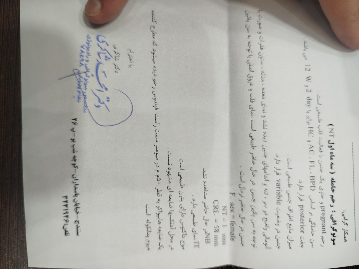 جواب سنو ان تی جواب سنو ان تی