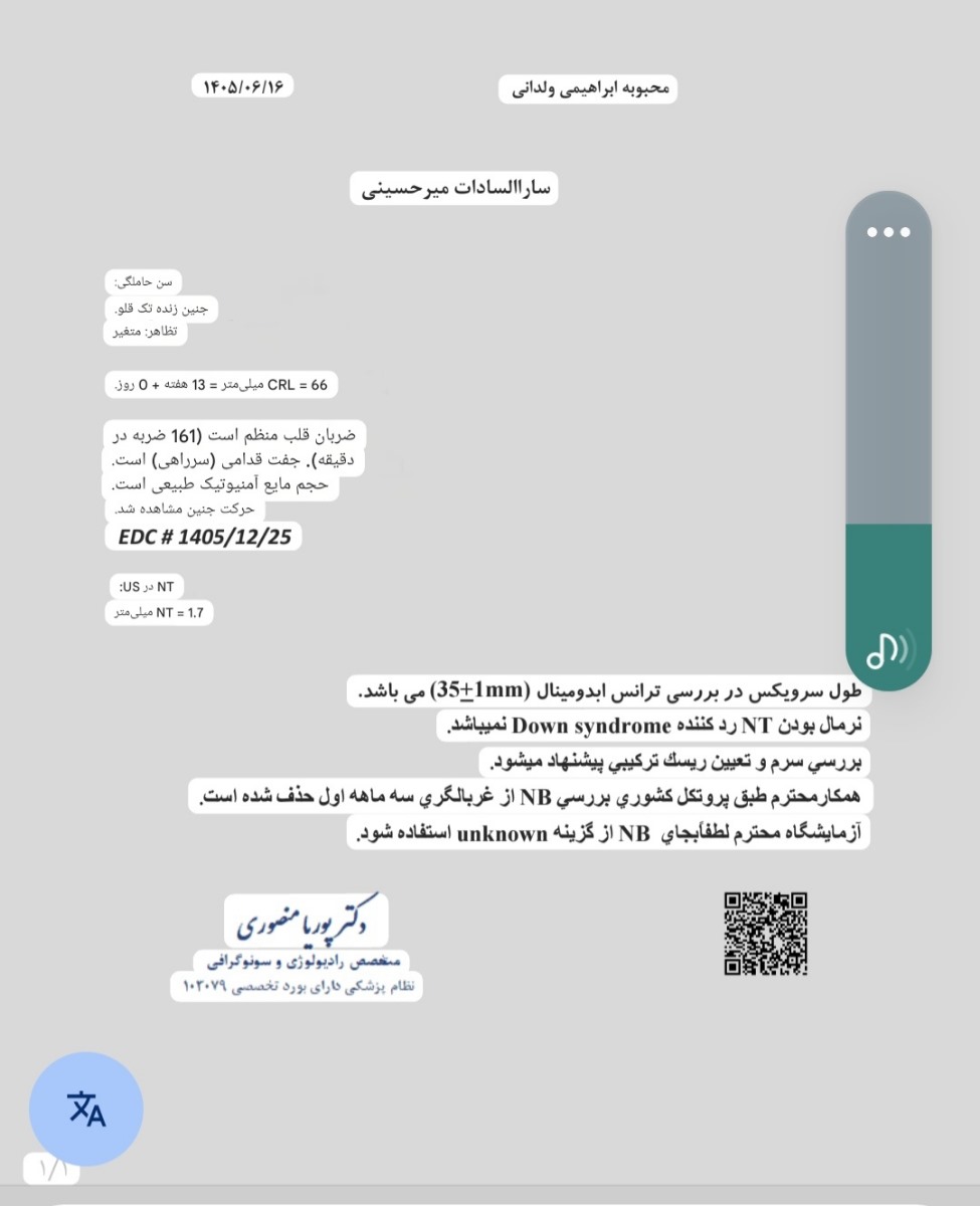 سنو ان تی ۱۳ هفته سنو ان تی ۱۳ هفته