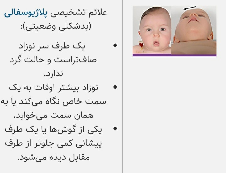 دقیقا فرم سرش مشابه این عکس هستش