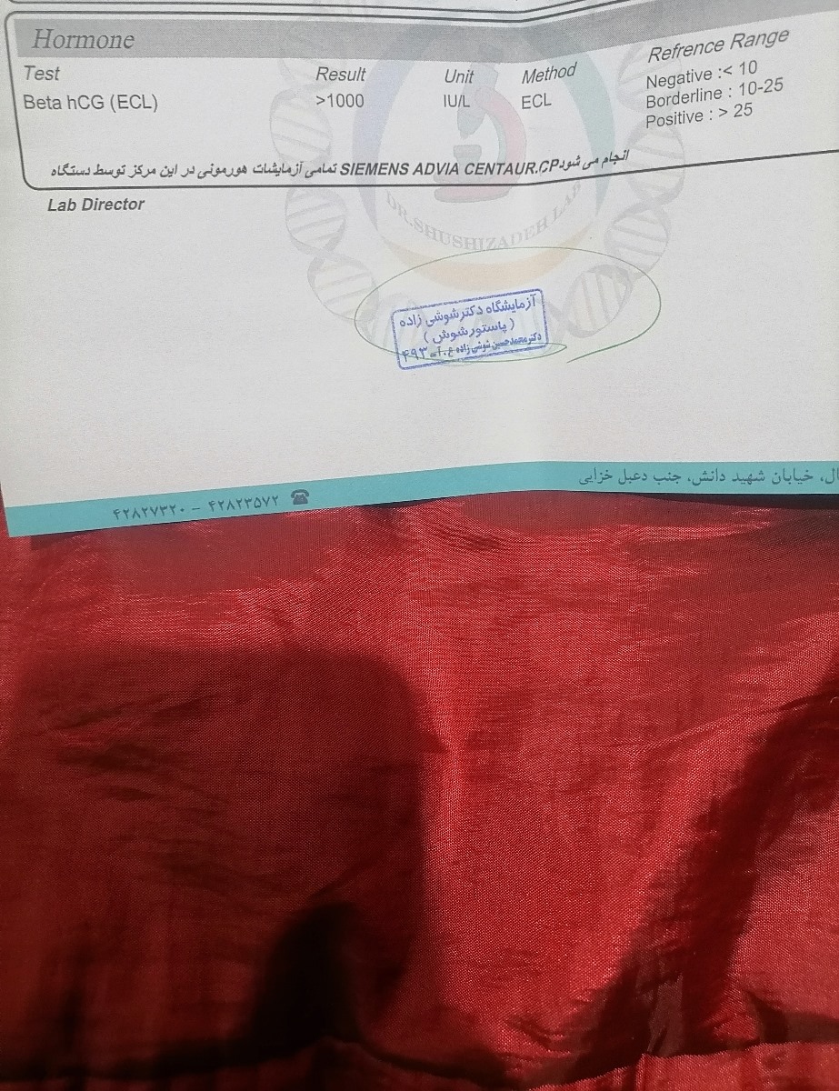 آزمایش بتا انجام دادم لطفاً چک کنید