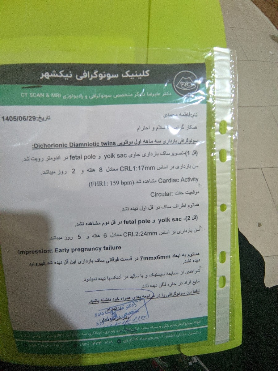 دوقلویی لکه بینی