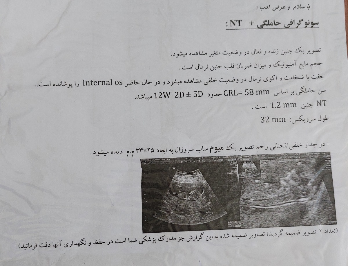 سونوگرافی ان‌تی