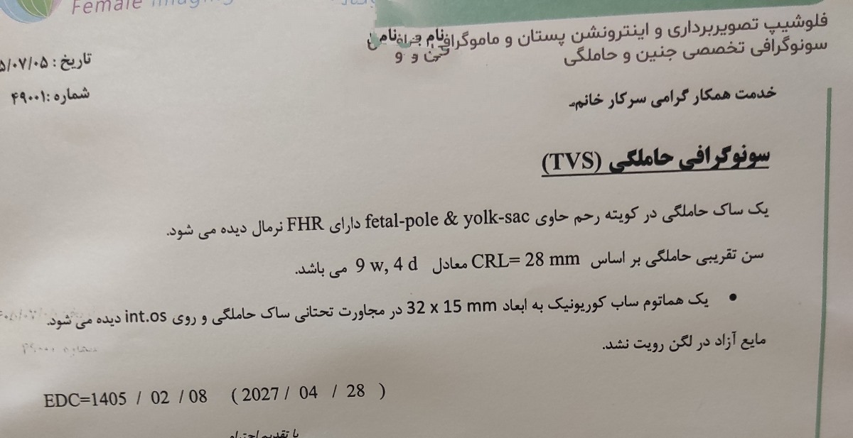 هماتوم روی دهانه رحم هماتوم روی دهانه رحم