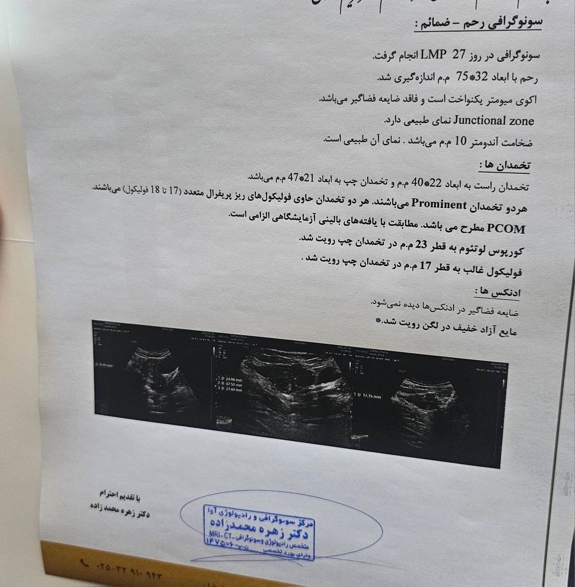 تفسیر عکس رنگی رحم