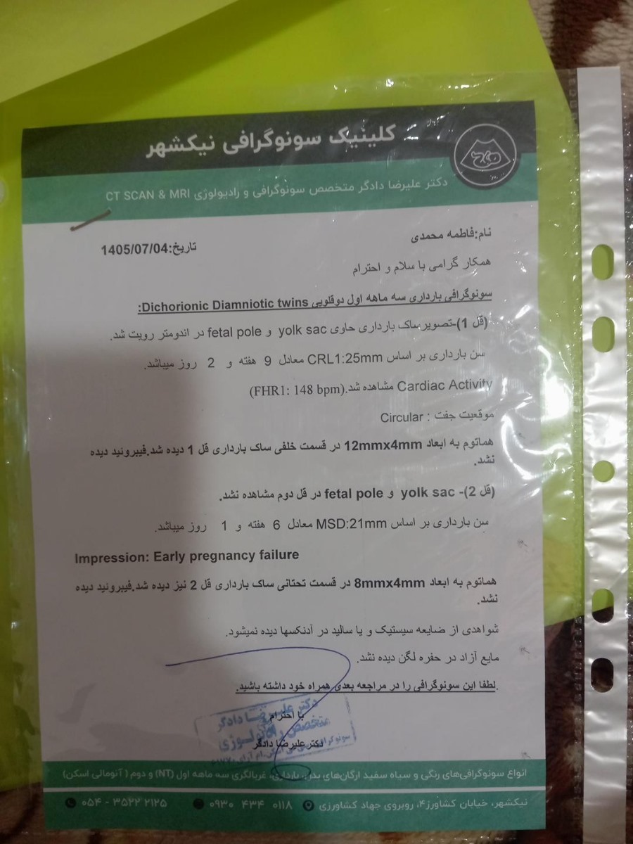 دوقلویی لکه بینی