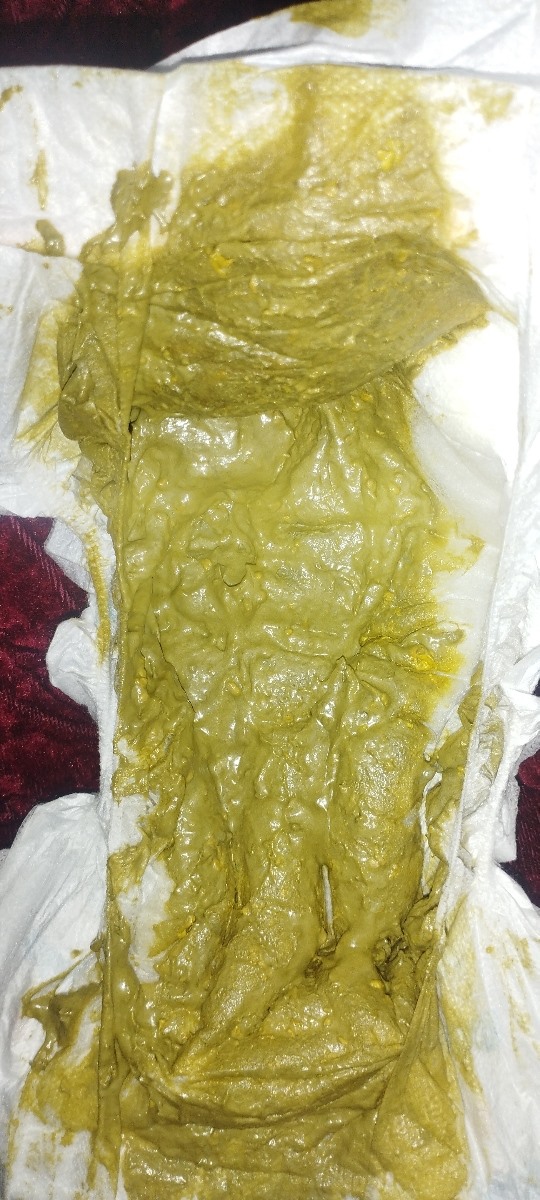 علت مدفوع سبز نوزاد❌❌عکس‌پوشک❌❌
