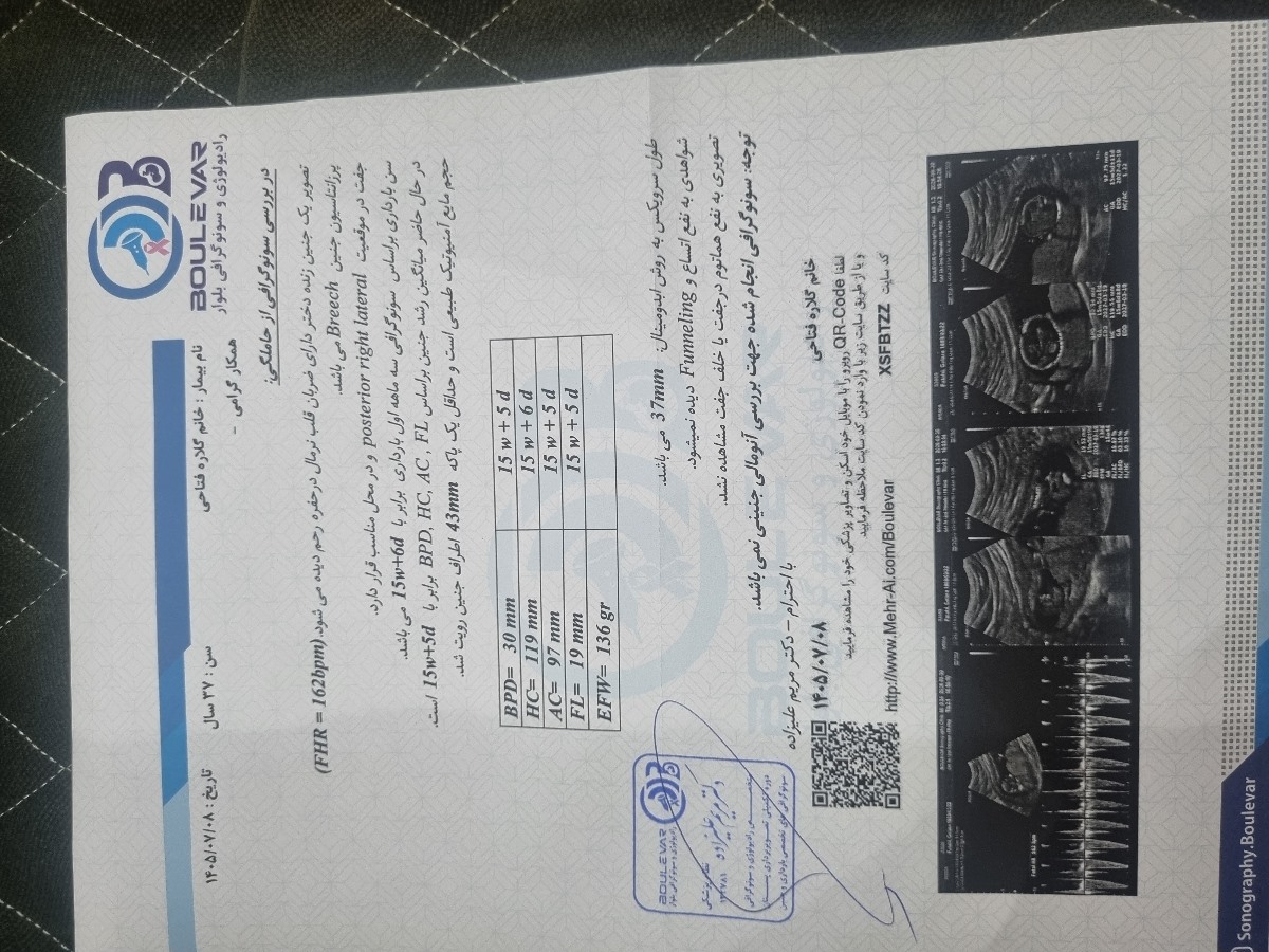 منظور از پاکه ۴۳ چیه
