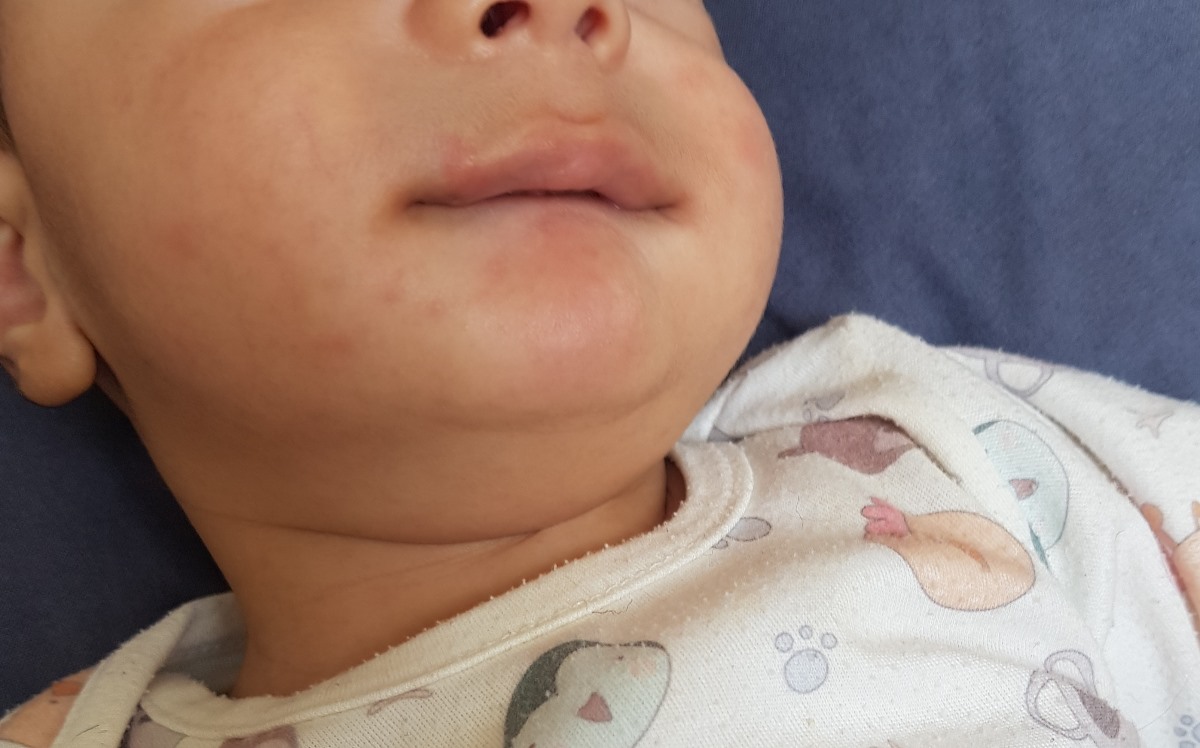 گرفتن لب پایین نوزاد ۴ماهو نیم گرفتن لب پایین نوزاد ۴ماهو نیم