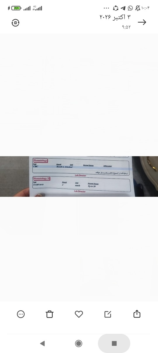 آزمایش کودک دو ساله