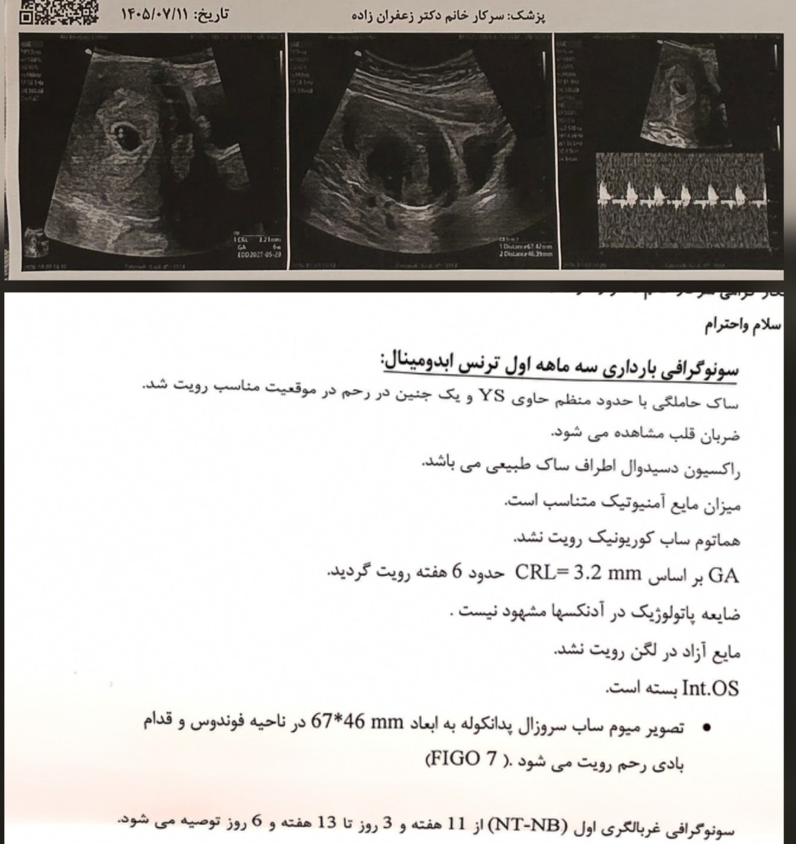لکه بینی هفته ۷ام