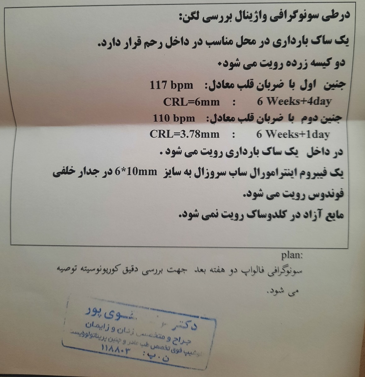 سونو دیروز