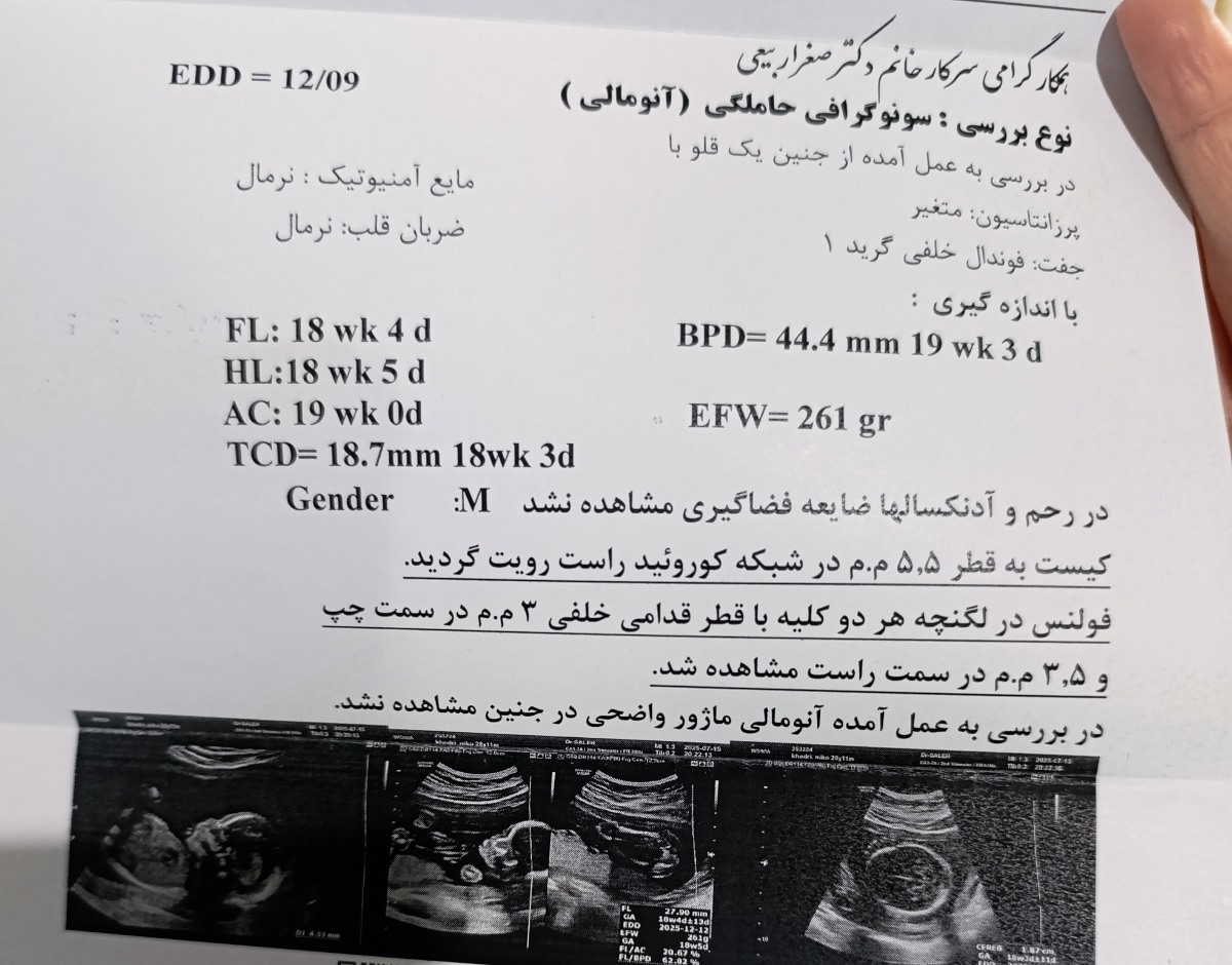 آزمایش غربالگری مرحله دوم آزمایش غربالگری مرحله دوم