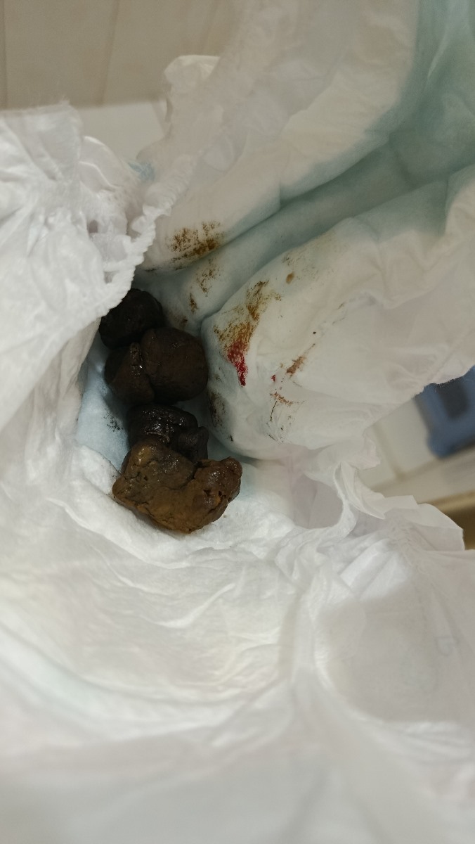 ❌مدفوع صفت همراه خون+عکس❌