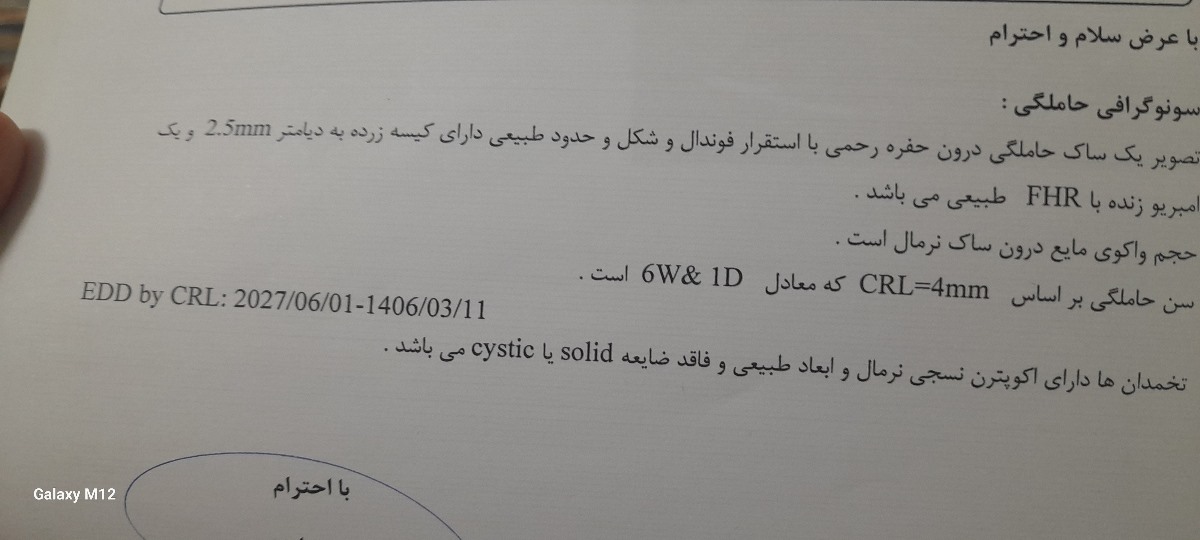 این سونو رو هم امشب دادم این سونو رو هم امشب دادم