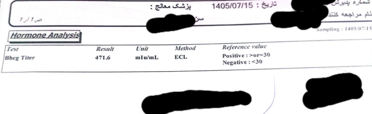 میزان آزمایش بتا خوب هست؟